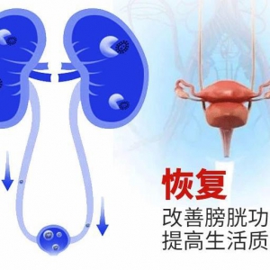 膀胱炎有哪些癥狀 男性如何預(yù)防膀胱炎發(fā)病